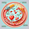 Wie Ezetimib das Lipidprofil beeinflusst